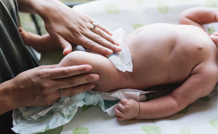 Hypospadias Surgery for Baby Boys